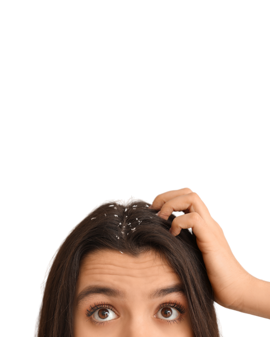 Getting Dandruff Under Control
