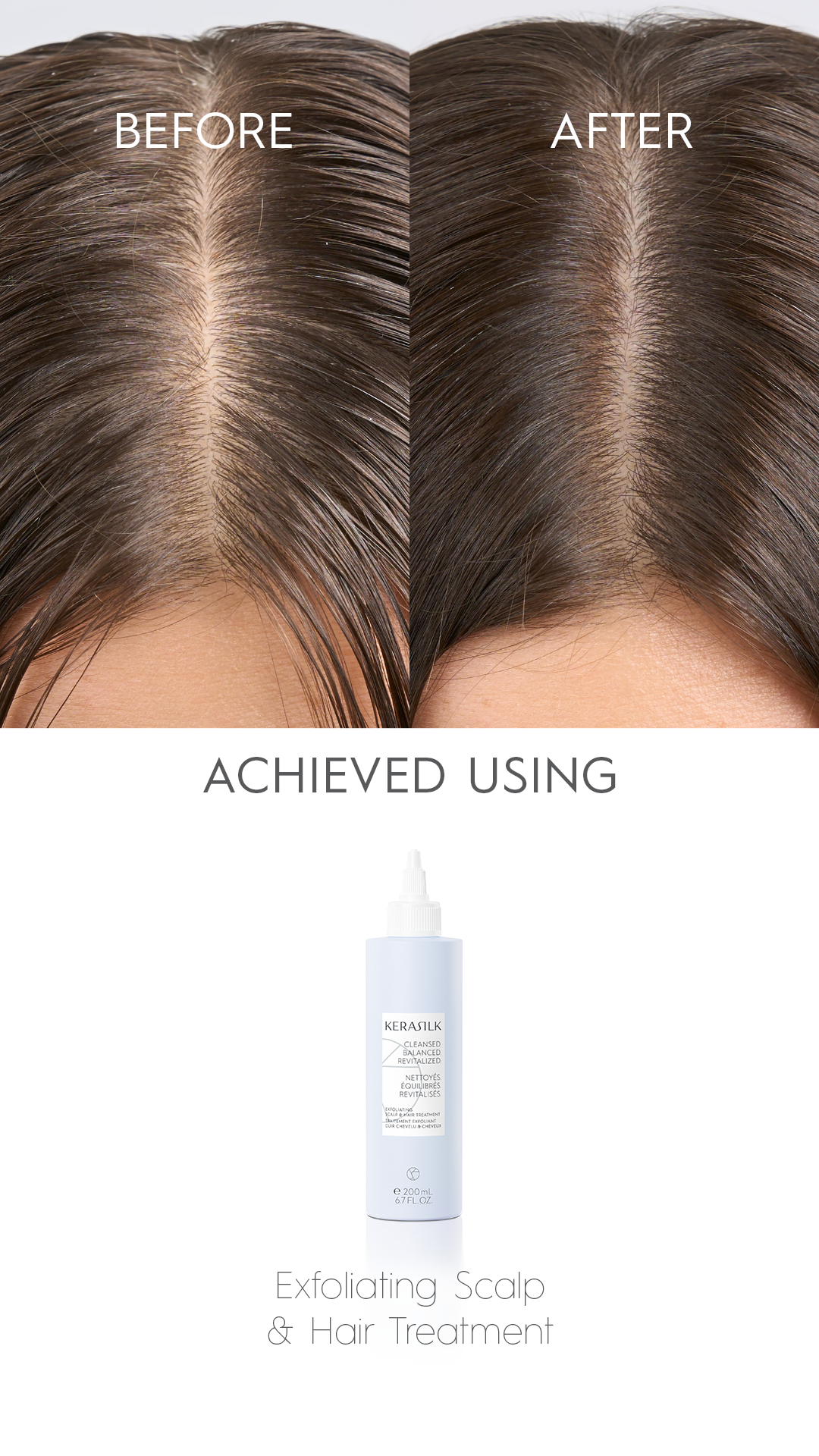kerasilk EXFOLIATING SCALP & HAIR TREATMENT